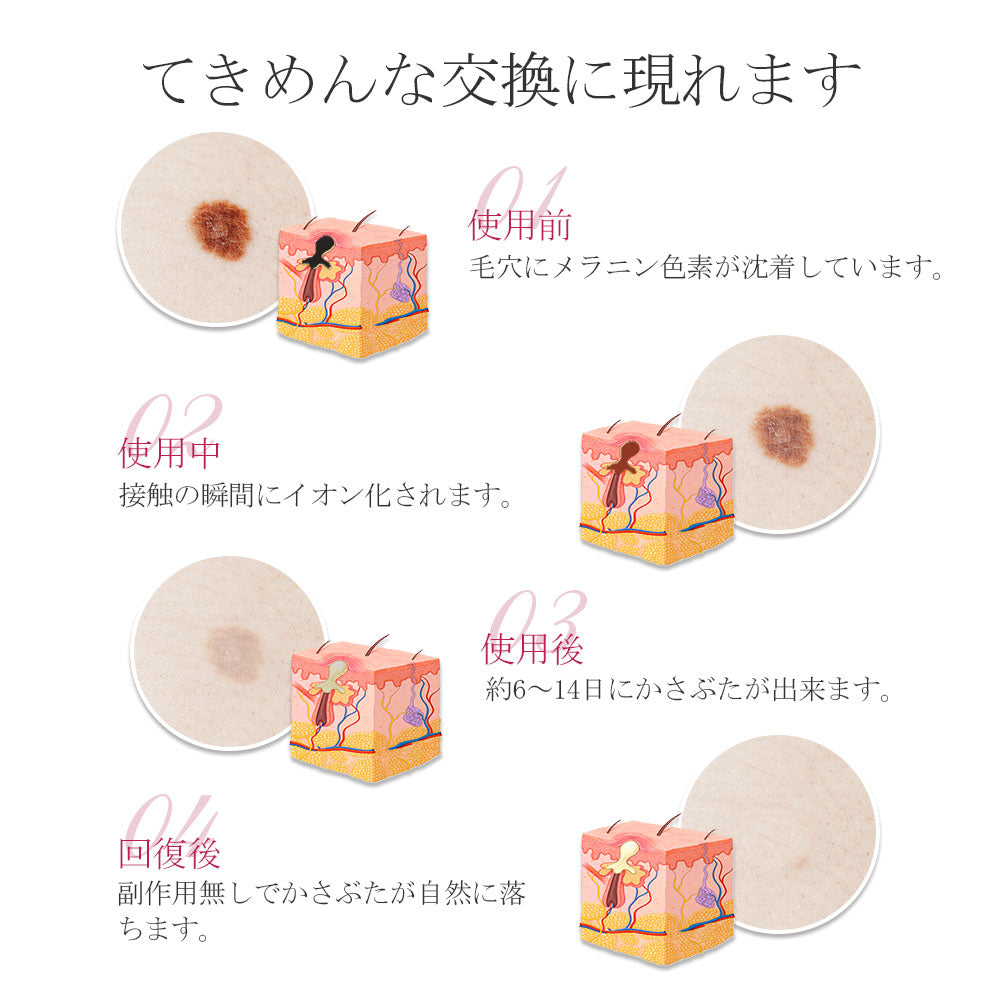 新デザイン 美顔器 面部儀 毛孔護理 光學美容毛孔護理 激光筆,激光去除筆,面部激光筆,面部器,去斑,疣,評論,污漬,痣,雀斑,USB充電,9級,美膚,美臉,激光點筆,家用