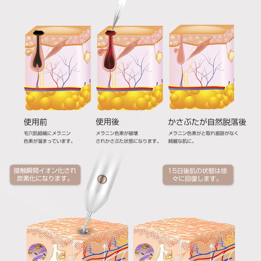 新デザイン 美顔器 面部儀 毛孔護理 光學美容毛孔護理