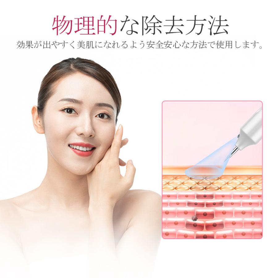 新デザイン 美顔器 面部儀 毛孔護理 光學美容毛孔護理 激光筆,激光去除筆,面部激光筆,面部器,去斑,疣,評論,污漬,痣,雀斑,USB充電,9級,美膚,美臉,激光點筆,家用