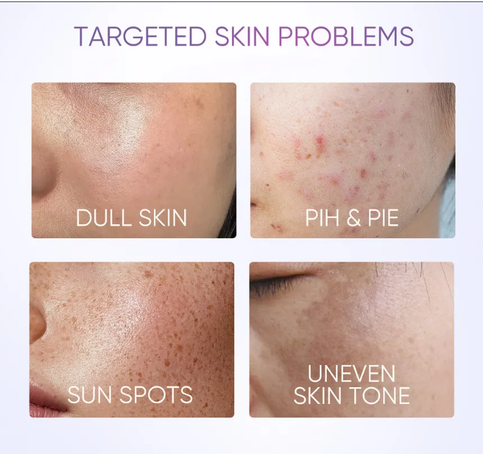 SKINTIFIC - Symwhite 377 Dark Spot Moisture Gel