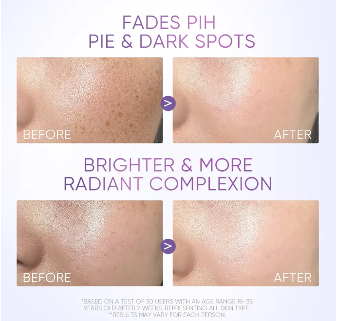 SKINTIFIC - Symwhite 377 Dark Spot Moisture Gel